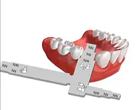 EKO-T SHAPE MEASURE INTERDENTAL DISTANCE FOR IMPLANT PLANNING. - Master